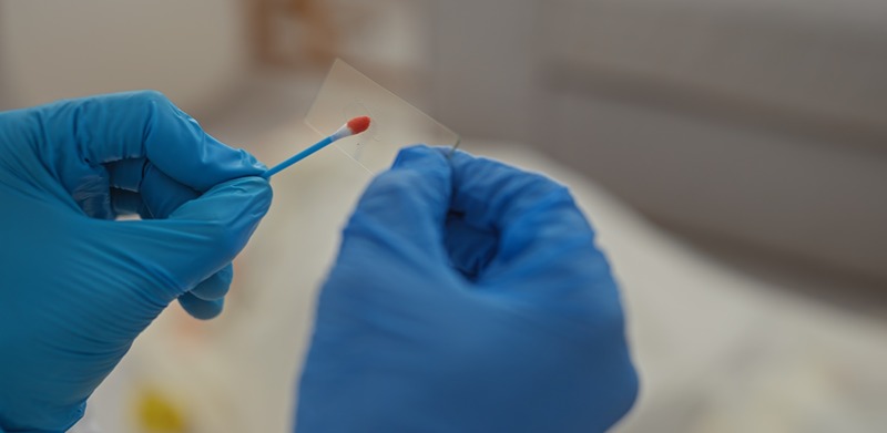 dna evidence in criminal charges